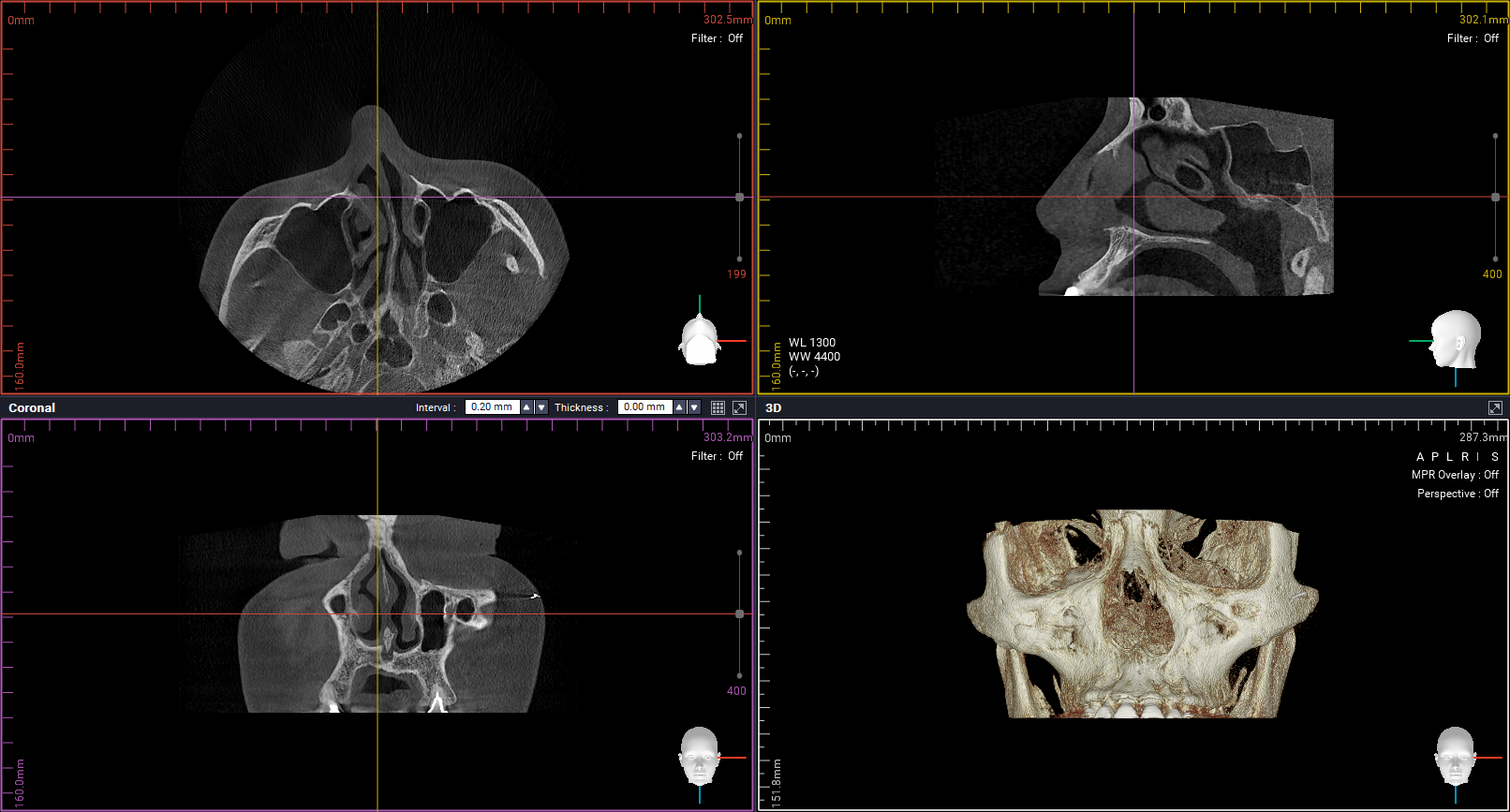 Function of the Nose